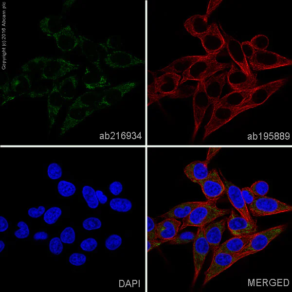 Immunocytochemistry/ Immunofluorescence - Alexa Fluor® 488 Anti-Tartrate Resistant Acid Phosphatase antibody [EPR15556] (AB216934)
