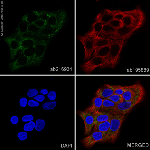 Immunocytochemistry/ Immunofluorescence - Alexa Fluor® 488 Anti-Tartrate Resistant Acid Phosphatase antibody [EPR15556] (AB216934)