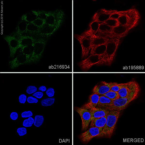 Immunocytochemistry/ Immunofluorescence - Alexa Fluor® 488 Anti-Tartrate Resistant Acid Phosphatase antibody [EPR15556] (AB216934)
