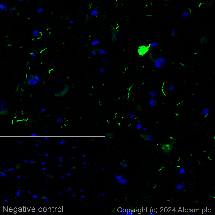 Immunohistochemistry (Frozen sections) - Alexa Fluor® 488 Anti-Tau Alzheimer's Disease antibody [GT-38] - Conformation-Specific (AB317594), expandable thumbnail
