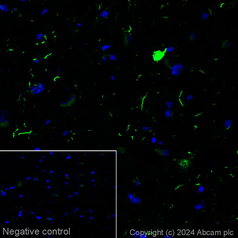 Immunohistochemistry (Frozen sections) - Alexa Fluor® 488 Anti-Tau Alzheimer's Disease antibody [GT-38] - Conformation-Specific (AB317594)