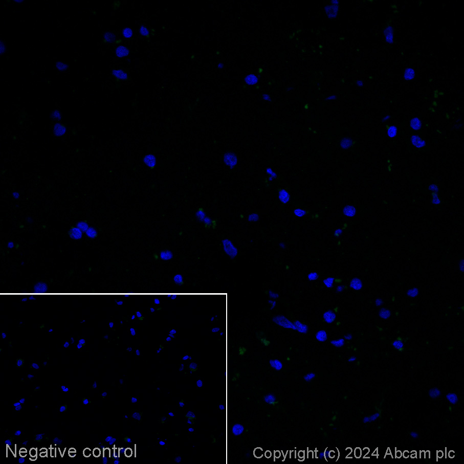 Immunohistochemistry (Frozen sections) - Alexa Fluor® 488 Anti-Tau Alzheimer's Disease antibody [GT-38] - Conformation-Specific (AB317594), expandable thumbnail