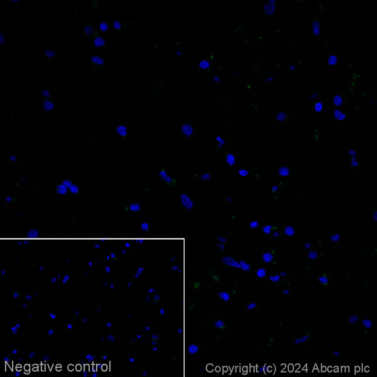 Immunohistochemistry (Frozen sections) - Alexa Fluor® 488 Anti-Tau Alzheimer's Disease antibody [GT-38] - Conformation-Specific (AB317594)