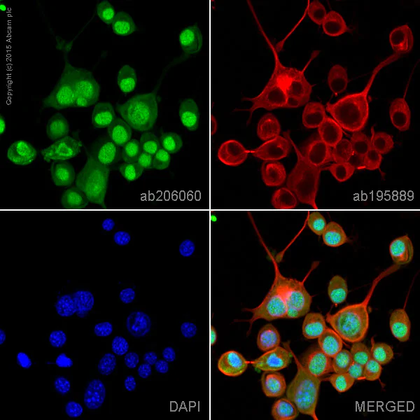 Immunocytochemistry/ Immunofluorescence - Alexa Fluor® 488 Anti-Tau antibody [EP2456Y] (AB206060)