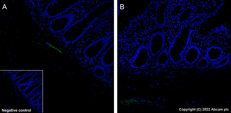 Immunohistochemistry - Alexa Fluor® 488 Anti-Tau (phospho S396) antibody [EPR2731] (AB302581)