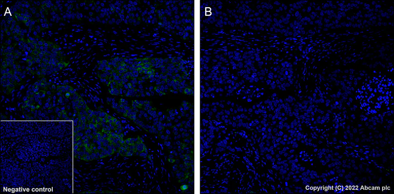 Immunohistochemistry - Alexa Fluor® 488 Anti-Tau (phospho S396) antibody [EPR2731] (AB302581)