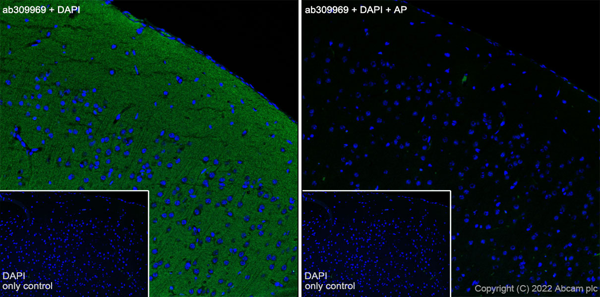 Immunohistochemistry (Frozen sections) - Alexa Fluor® 488 Anti-Tau (phospho T181) antibody [EPR23506-107] (AB309969), expandable thumbnail