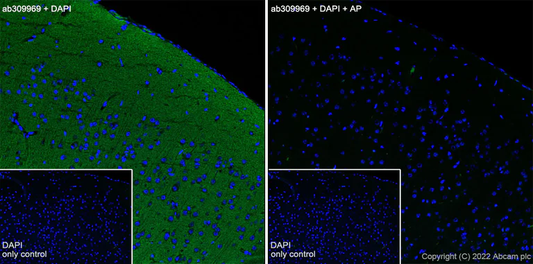Immunohistochemistry (Frozen sections) - Alexa Fluor® 488 Anti-Tau (phospho T181) antibody [EPR23506-107] (AB309969)