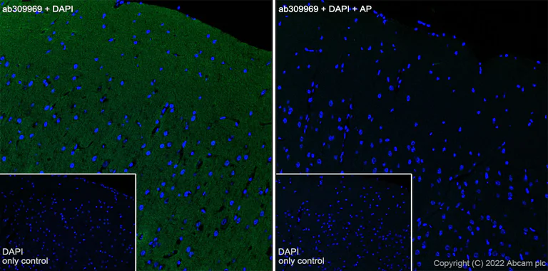 Immunohistochemistry (Frozen sections) - Alexa Fluor® 488 Anti-Tau (phospho T181) antibody [EPR23506-107] (AB309969)