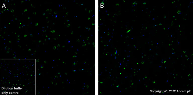 Immunohistochemistry (Formalin/PFA-fixed paraffin-embedded sections) - Alexa Fluor® 488 Anti-Tau (phospho T231) antibody [EPR2488] (AB306601)