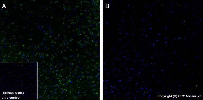 Immunohistochemistry (Formalin/PFA-fixed paraffin-embedded sections) - Alexa Fluor® 488 Anti-Tau (phospho T231) antibody [EPR2488] (AB306601)
