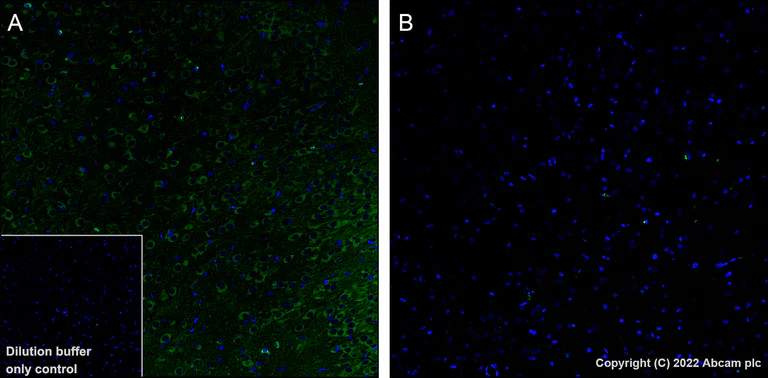 Immunohistochemistry (Formalin/PFA-fixed paraffin-embedded sections) - Alexa Fluor® 488 Anti-Tau (phospho T231) antibody [EPR2488] (AB306601)