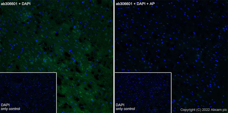 Immunohistochemistry (Frozen sections) - Alexa Fluor® 488 Anti-Tau (phospho T231) antibody [EPR2488] (AB306601)