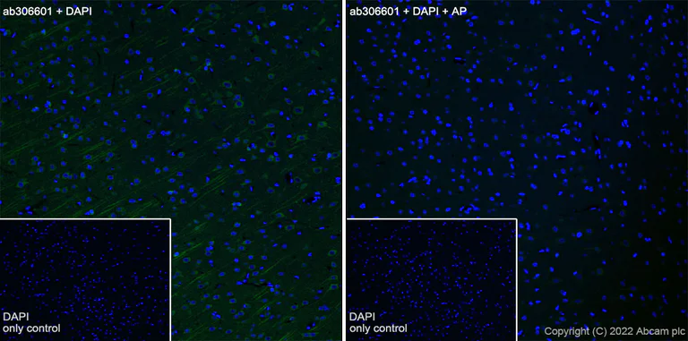 Immunohistochemistry (Frozen sections) - Alexa Fluor® 488 Anti-Tau (phospho T231) antibody [EPR2488] (AB306601)