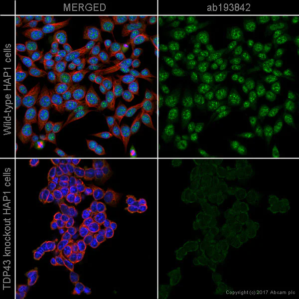 Immunocytochemistry/ Immunofluorescence - Alexa Fluor® 488 Anti-TDP43 antibody [EPR5810] (AB193842)