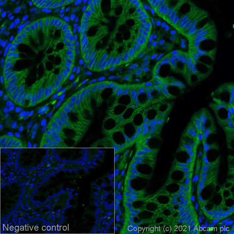 Immunohistochemistry (Formalin/PFA-fixed paraffin-embedded sections) - Alexa Fluor® 488 Anti-TFEB antibody [EPR22940-151] (AB282162)