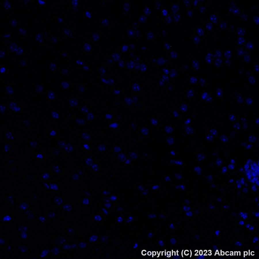 Immunohistochemistry (Formalin/PFA-fixed paraffin-embedded sections) - Alexa Fluor® 488 Anti-TGF beta 1 antibody [EPR21143] (AB313729), expandable thumbnail