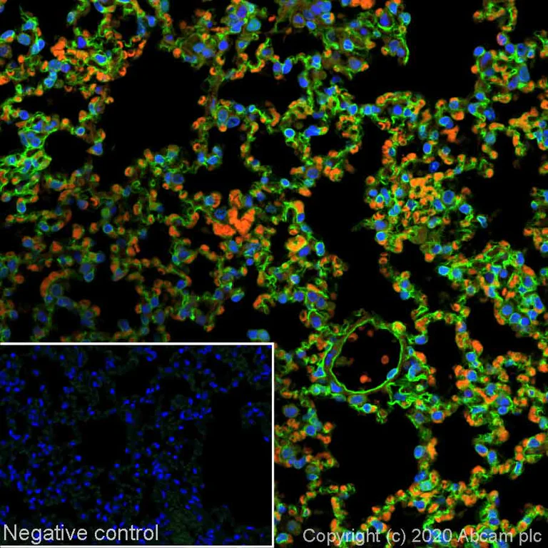 Immunohistochemistry (Formalin/PFA-fixed paraffin-embedded sections) - Alexa Fluor® 488 Anti-Thrombomodulin antibody [EPR18217] (AB252145)