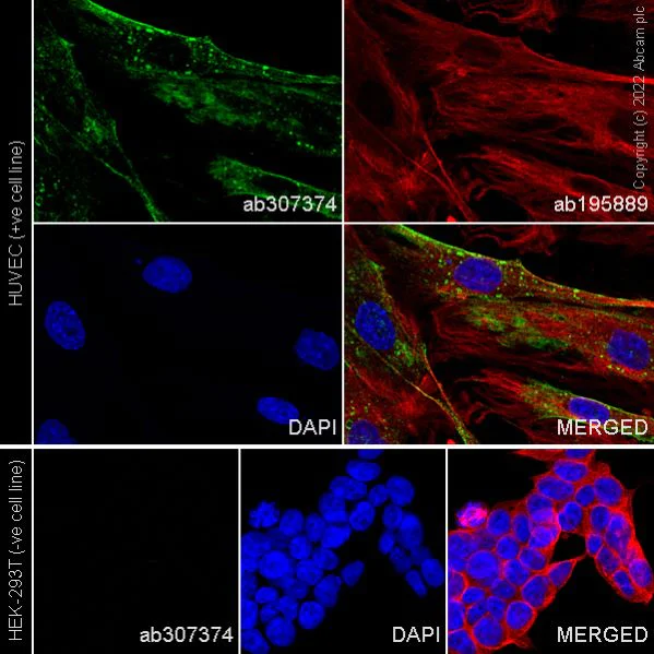 Immunocytochemistry/ Immunofluorescence - Alexa Fluor® 488 Anti-TIE2 antibody [EPR21915] (AB307374)