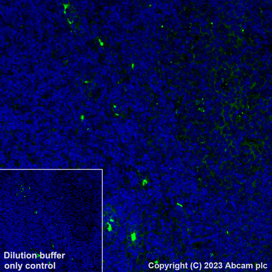 Immunohistochemistry (Formalin/PFA-fixed paraffin-embedded sections) - Alexa Fluor® 488 Anti-TIGIT antibody [EPR26037-152] (AB308535), expandable thumbnail