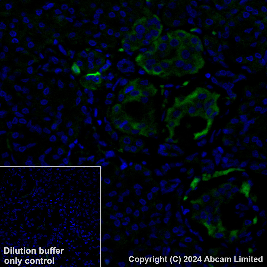 Immunohistochemistry (Formalin/PFA-fixed paraffin-embedded sections) - Alexa Fluor® 488 Anti-TIMP1 antibody [EPR18352] (AB321852), expandable thumbnail