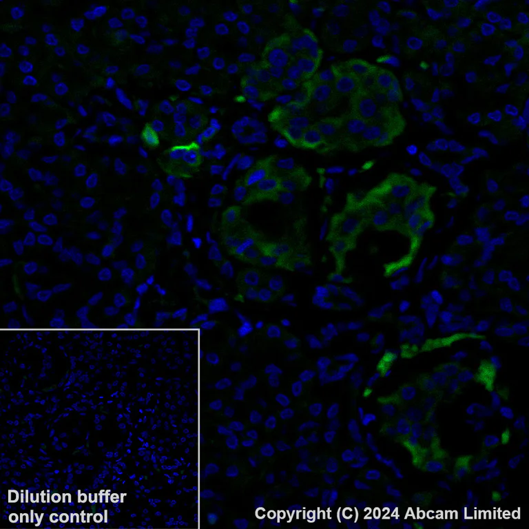 Immunohistochemistry (Formalin/PFA-fixed paraffin-embedded sections) - Alexa Fluor® 488 Anti-TIMP1 antibody [EPR18352] (AB321852)