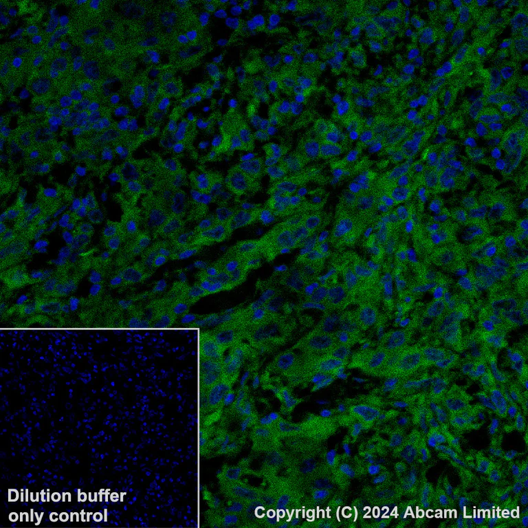Immunohistochemistry (Formalin/PFA-fixed paraffin-embedded sections) - Alexa Fluor® 488 Anti-TIMP1 antibody [EPR18352] (AB321852)