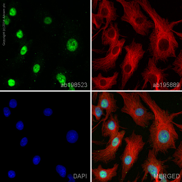Immunocytochemistry/ Immunofluorescence - Alexa Fluor® 488 Anti-TLE 1 antibody [EPR9386(2)] (AB198523)