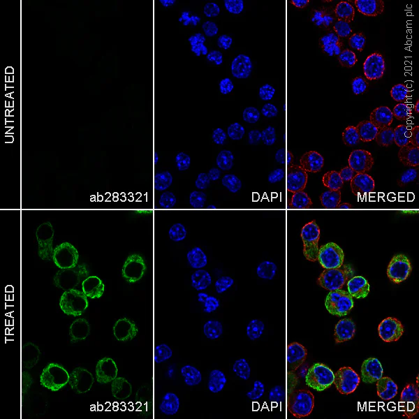 Immunocytochemistry/ Immunofluorescence - Alexa Fluor® 488 Anti-TNF alpha antibody [EPR21753-109] (AB283321)