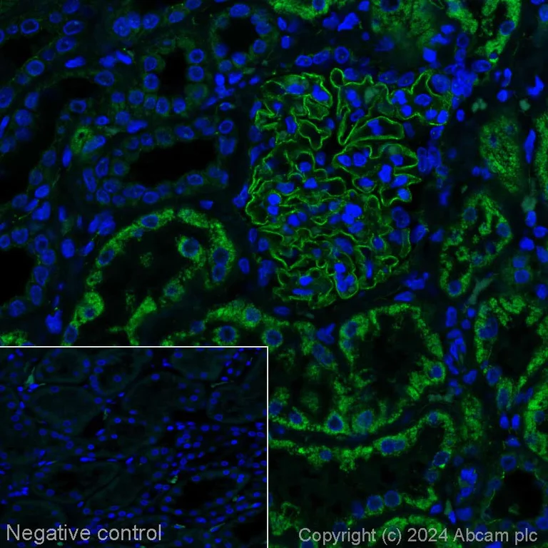 Immunohistochemistry (Formalin/PFA-fixed paraffin-embedded sections) - Alexa Fluor® 488 Anti-TNFAIP3 antibody [EPR2663] (AB197541)
