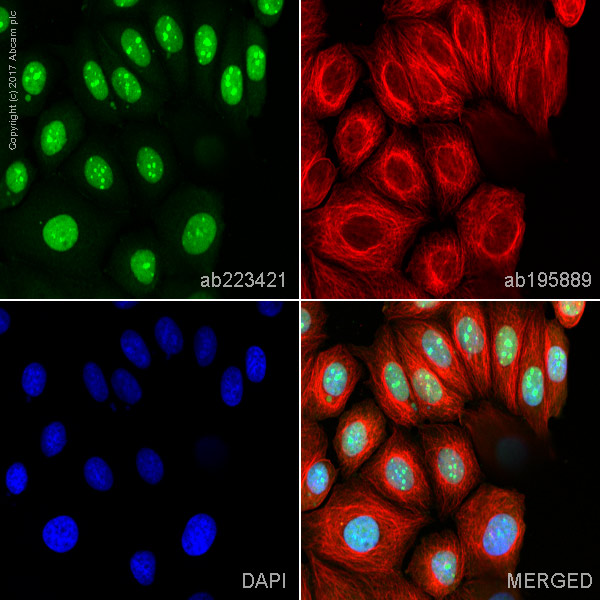 Immunocytochemistry/ Immunofluorescence - Alexa Fluor® 488 Anti-Topoisomerase I antibody [EPR5376(2)] (AB223421)