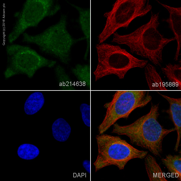 Immunocytochemistry/ Immunofluorescence - Alexa Fluor® 488 Anti-TRAF6 antibody [EP591Y] (AB214638)