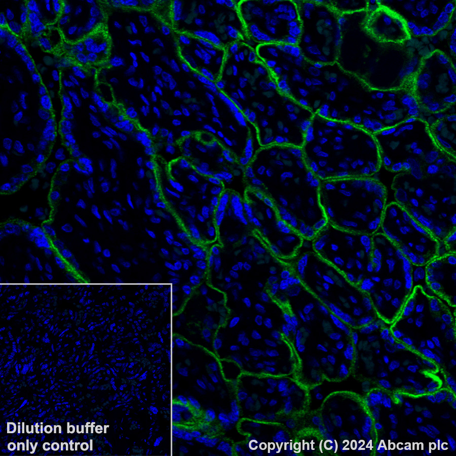 Alexa Fluor® 488 Anti-Transferrin Receptor antibody [EPR20584