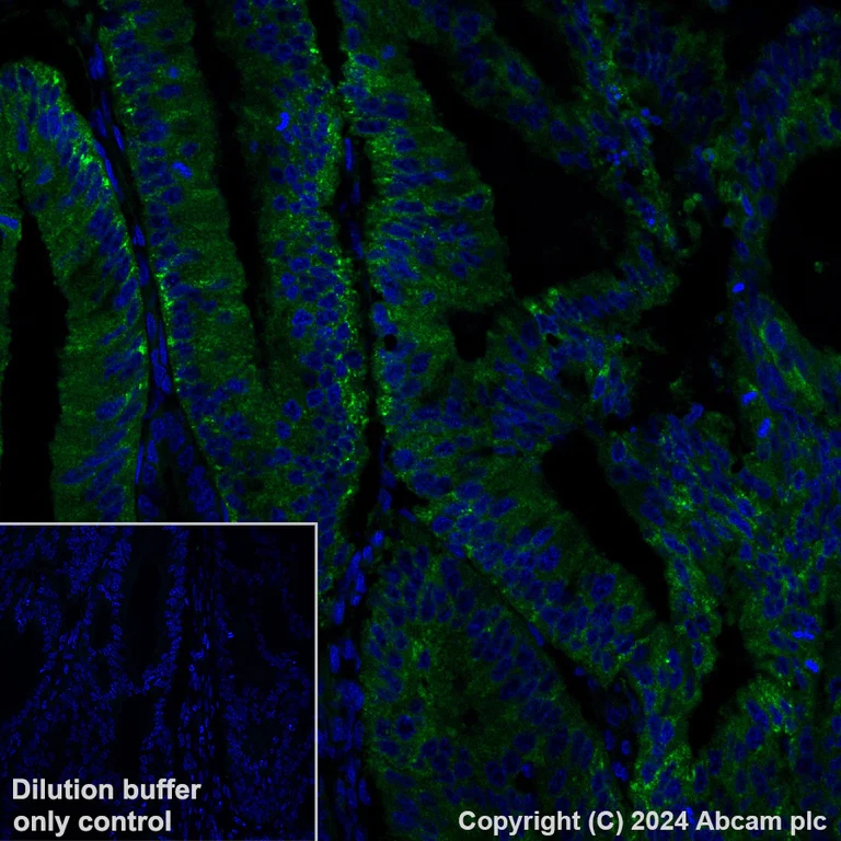 Immunohistochemistry (Formalin/PFA-fixed paraffin-embedded sections) - Alexa Fluor® 488 Anti-Transferrin Receptor antibody [EPR20584] (AB317529)