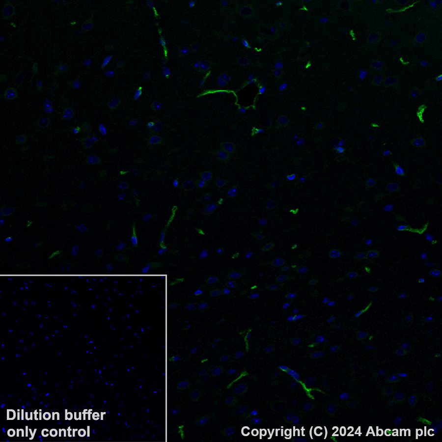 Alexa Fluor® 488 Anti-Transferrin Receptor antibody [EPR20584
