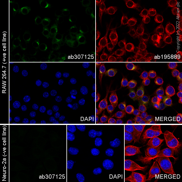Immunocytochemistry/ Immunofluorescence - Alexa Fluor® 488 Anti-TREM2 antibody [EPR23177-106] (AB307125), expandable thumbnail