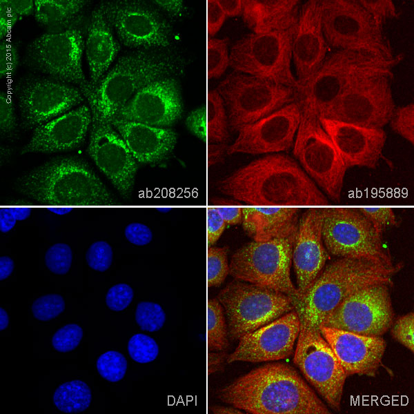 Immunocytochemistry/ Immunofluorescence - Alexa Fluor® 488 Anti-TRK fused gene antibody [EPR8766] (AB208256)
