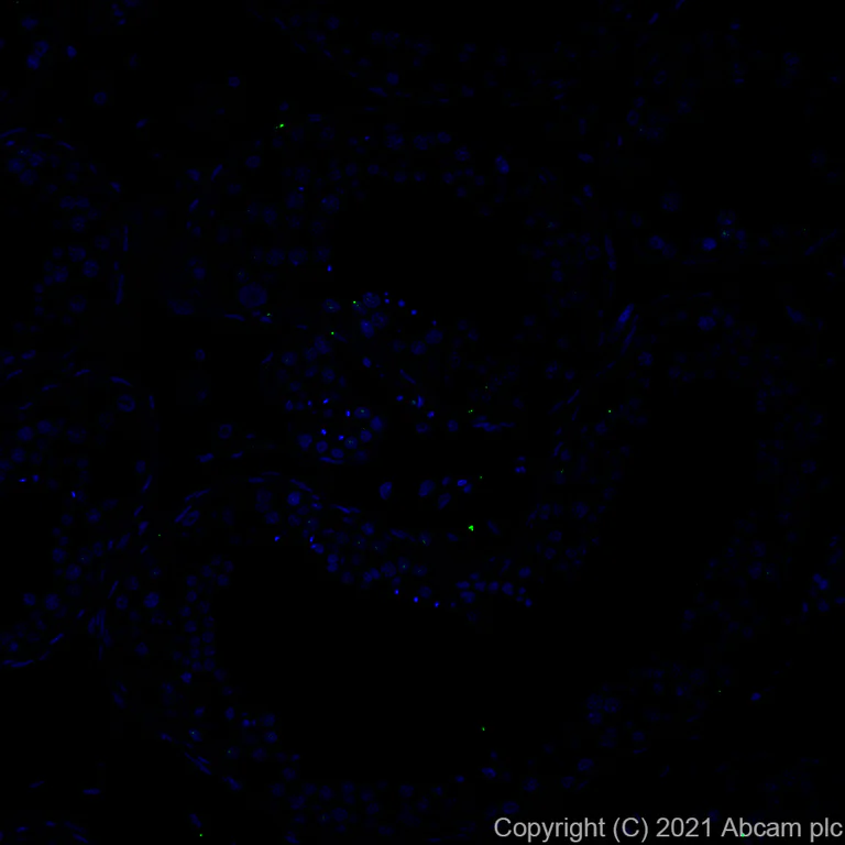 Immunohistochemistry (Formalin/PFA-fixed paraffin-embedded sections) - Alexa Fluor® 488 Anti-TROP2 antibody [EPR20043] (AB281933)