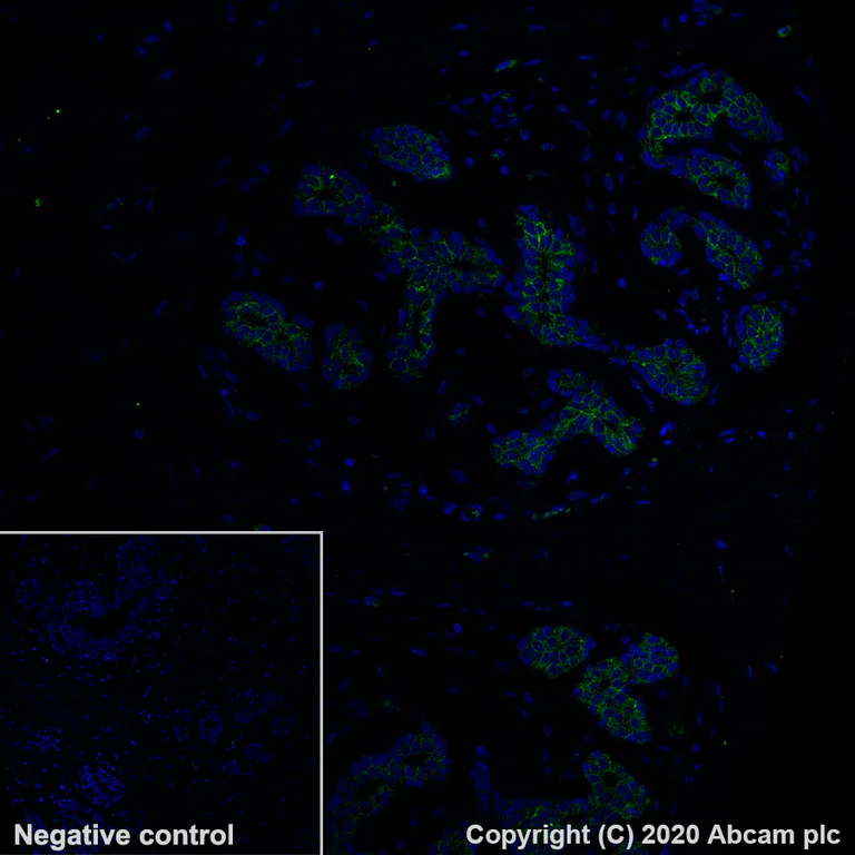 Immunohistochemistry (Formalin/PFA-fixed paraffin-embedded sections) - Alexa Fluor® 488 Anti-TROP2 antibody [EPR20043] (AB281933)