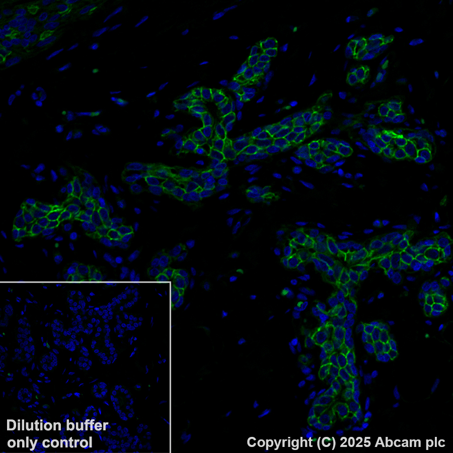 Immunohistochemistry (Formalin/PFA-fixed paraffin-embedded sections) - Alexa Fluor® 488 Anti-TROP2 antibody [EPR20043] (AB281933)