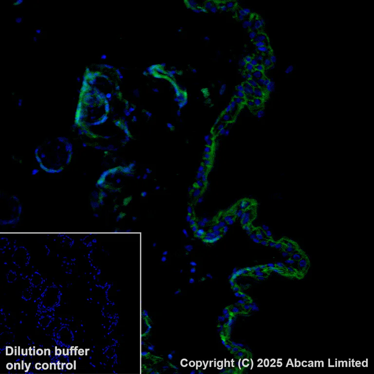 Immunohistochemistry (Formalin/PFA-fixed paraffin-embedded sections) - Alexa Fluor® 488 Anti-TROP2 antibody [EPR20043] (AB281933)