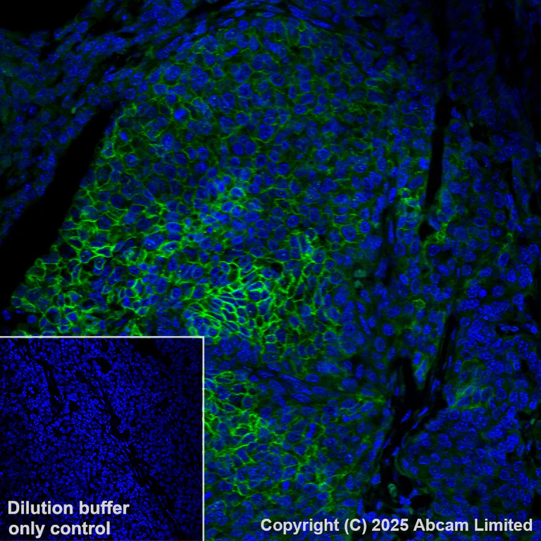Immunohistochemistry (Formalin/PFA-fixed paraffin-embedded sections) - Alexa Fluor® 488 Anti-TROP2 antibody [EPR20043] (AB281933)