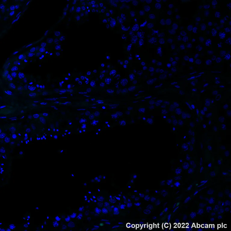 Immunohistochemistry (Formalin/PFA-fixed paraffin-embedded sections) - Alexa Fluor® 488 Anti-TROP2 antibody [EPR20043] (AB281933)