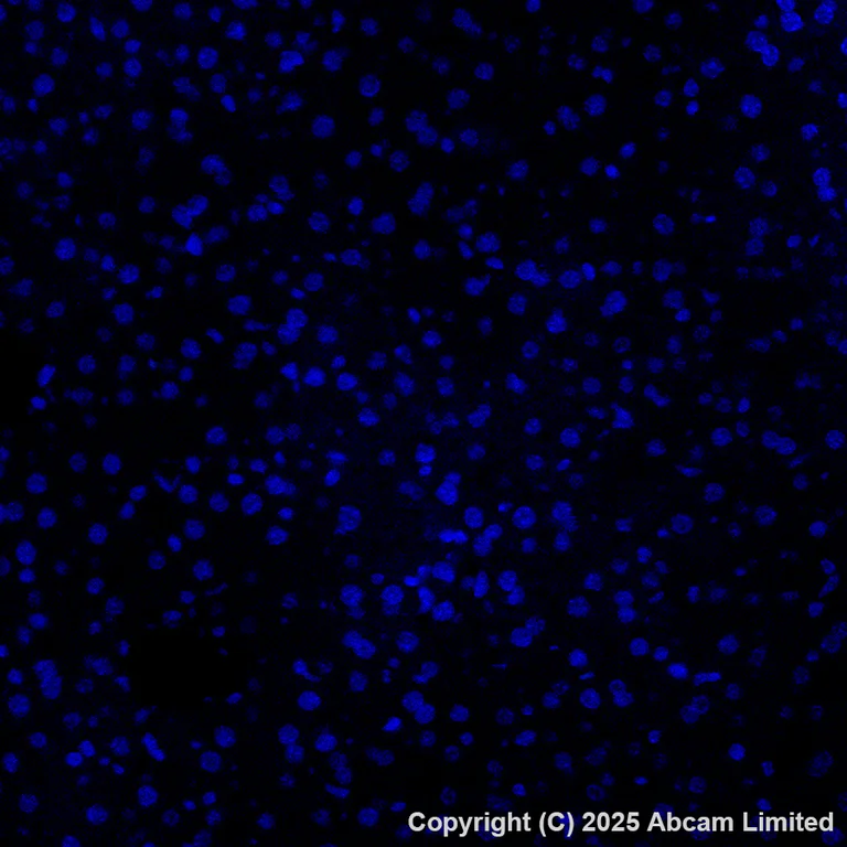Immunohistochemistry (Formalin/PFA-fixed paraffin-embedded sections) - Alexa Fluor® 488 Anti-TROP2 antibody [EPR20043] (AB281933)