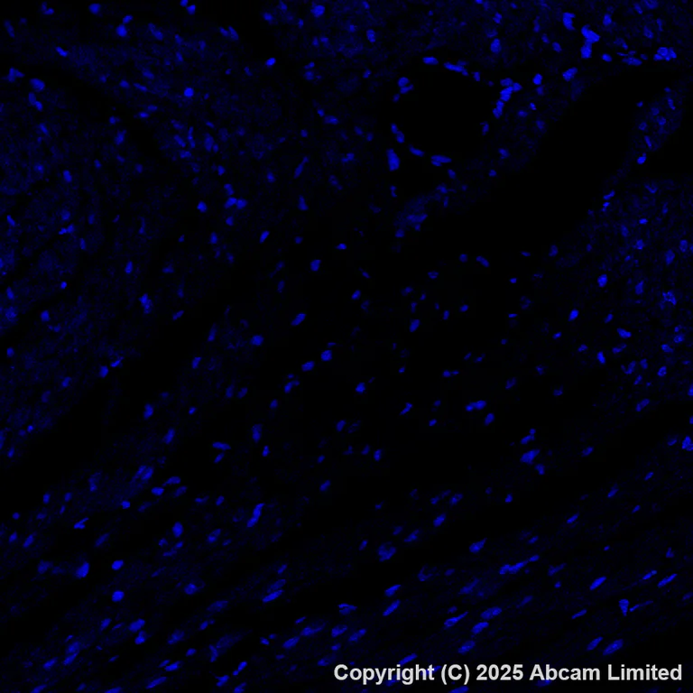Immunohistochemistry (Formalin/PFA-fixed paraffin-embedded sections) - Alexa Fluor® 488 Anti-TROP2 antibody [EPR20043] (AB281933)