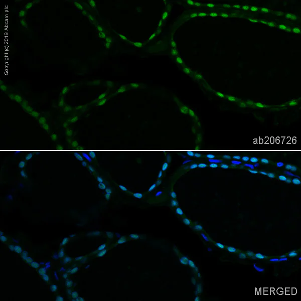 Immunohistochemistry (Formalin/PFA-fixed paraffin-embedded sections) - Alexa Fluor® 488 Anti-TTF1/Nkx2-1 antibody [EPR5955(2)] (AB206726)