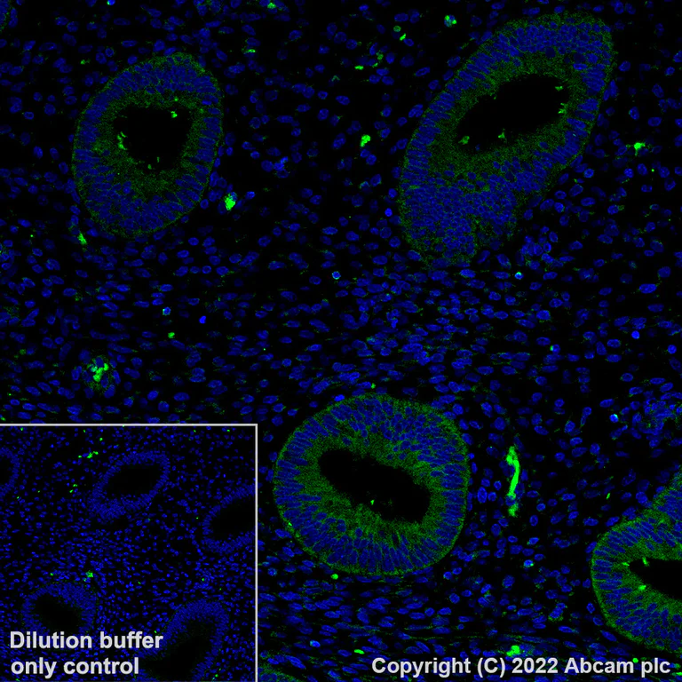 Immunohistochemistry (Formalin/PFA-fixed paraffin-embedded sections) - Alexa Fluor® 488 Anti-TUBA4A antibody [EPR13477(B)] - Microtubule Marker (AB307611)