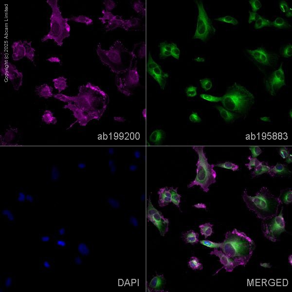 Immunocytochemistry/ Immunofluorescence - Alexa Fluor® 488 Anti-Tubulin antibody [YOL1/34] - Microtubule Marker (AB195883), expandable thumbnail