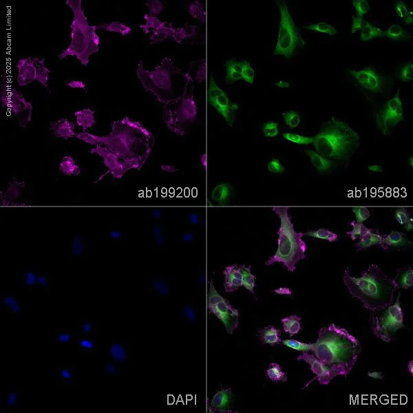 Immunocytochemistry/ Immunofluorescence - Alexa Fluor® 488 Anti-Tubulin antibody [YOL1/34] - Microtubule Marker (AB195883)