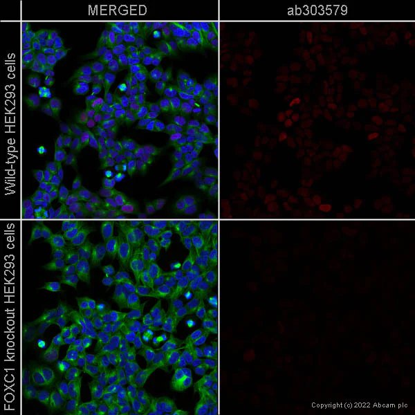 Immunocytochemistry/ Immunofluorescence - Alexa Fluor® 488 Anti-Tubulin antibody [YOL1/34] - Microtubule Marker (AB195883)